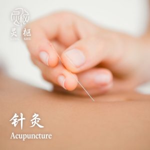Acupuncture 1000x 300x300