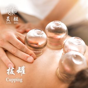 Cupping therapy cheras