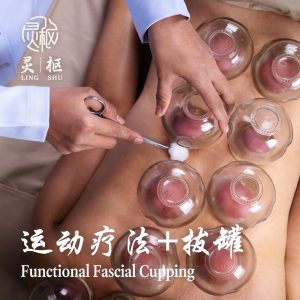 Functional Fascial Cupping 1000x 300x300