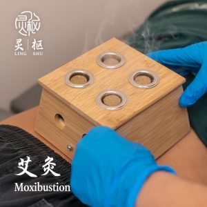 Moxibustion 1000x 300x300