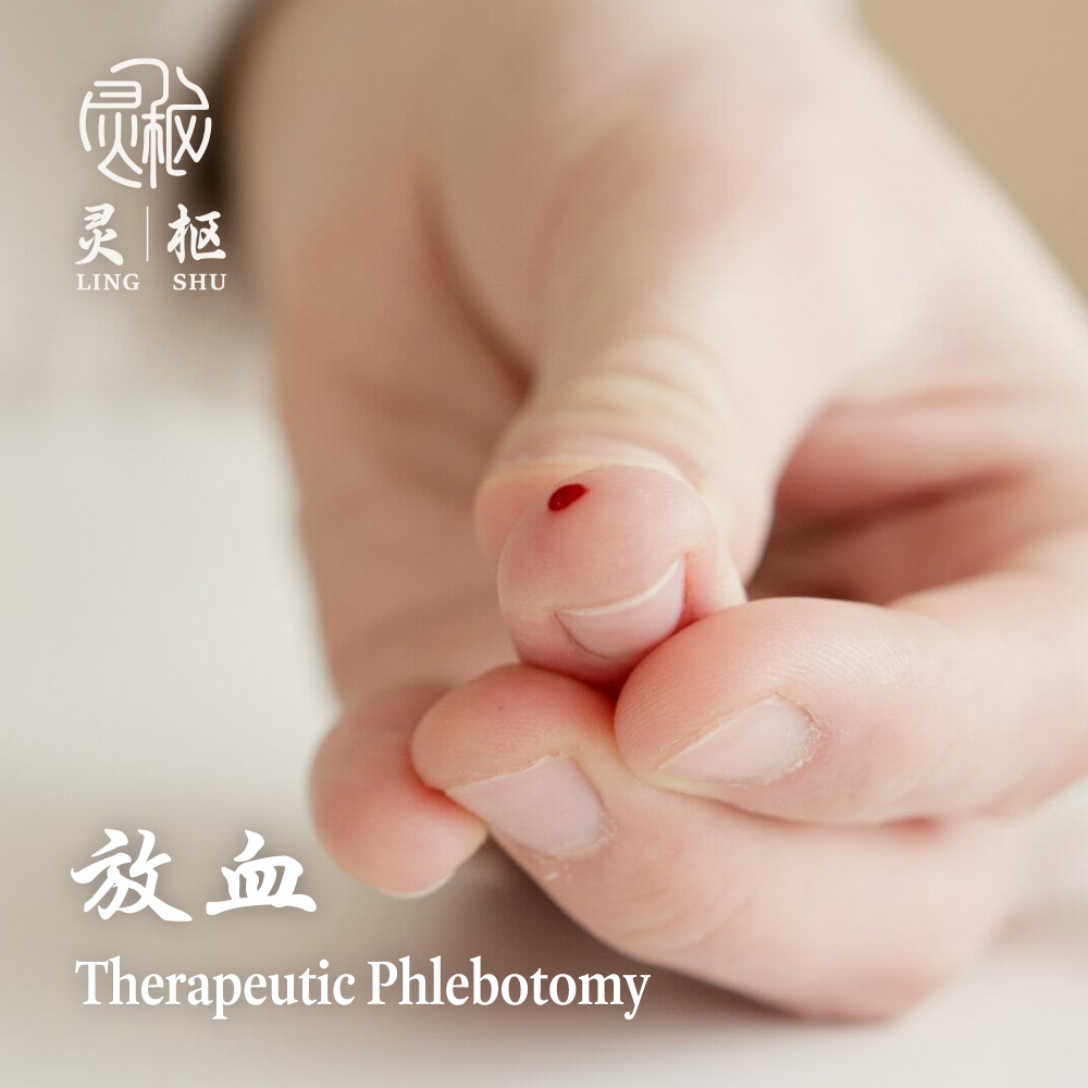 Therapeutic Phlebotomy 1000x