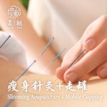 Slimming Acupuncture + Mobile Cupping
